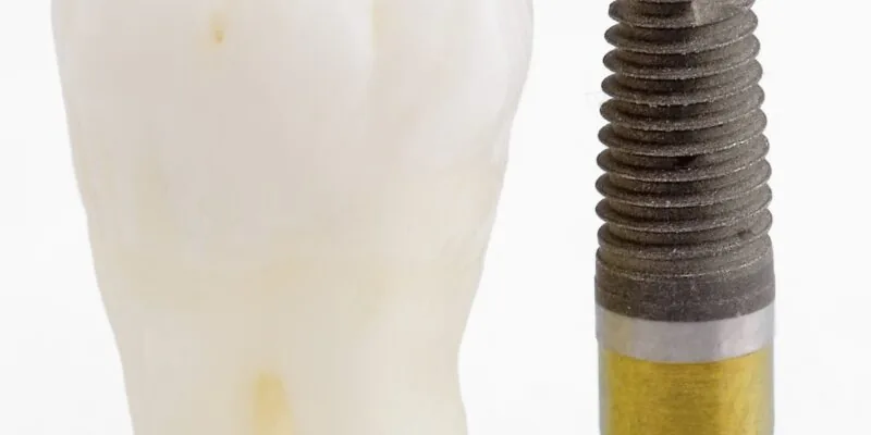 A lost tooth and a dental implant in Englewood.